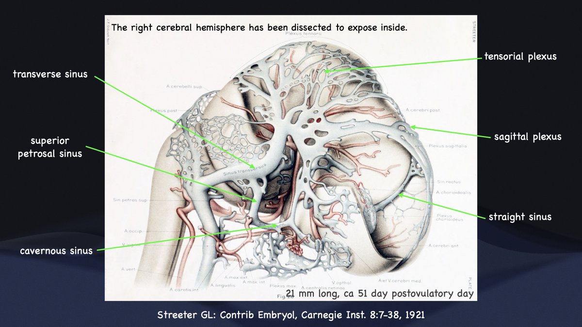 Early cerebral venous drainage at embryo 21 mm long, changed from primary head sinus to newly formed dorsal venous sinuses. Dural covering is incomplete at this stage and tentorium cerebelli is formed soon.