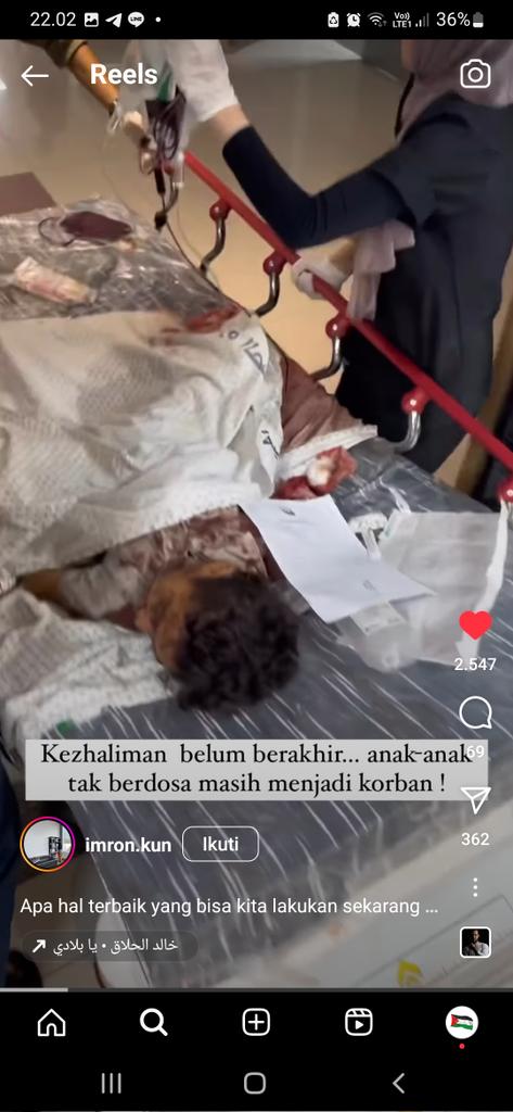 jjaesaa_'s tweet photo. yang masih danial, netral, bela israel, bahkan ada juga yg MASIH menyalahkan palestina, pliss otak kalian dimana??? Inii ada bukti nyata kejahatan zioniss dan kalian masih bilang "NETRAL"?? dann banyak juga yang masih bela zionis? demi apapun, kalian emng gawaras
#FreePalaestine https://t.co/5DT5eBVtAV