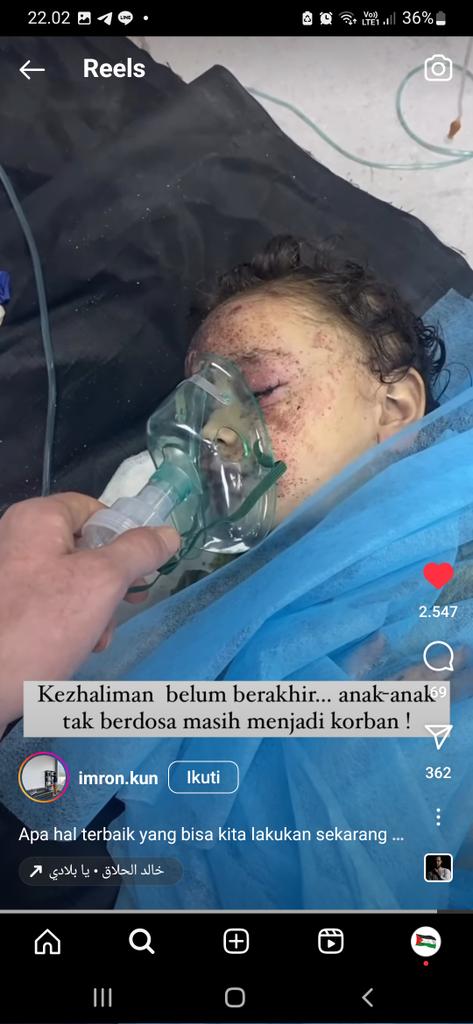 jjaesaa_'s tweet photo. yang masih danial, netral, bela israel, bahkan ada juga yg MASIH menyalahkan palestina, pliss otak kalian dimana??? Inii ada bukti nyata kejahatan zioniss dan kalian masih bilang "NETRAL"?? dann banyak juga yang masih bela zionis? demi apapun, kalian emng gawaras
#FreePalaestine https://t.co/5DT5eBVtAV