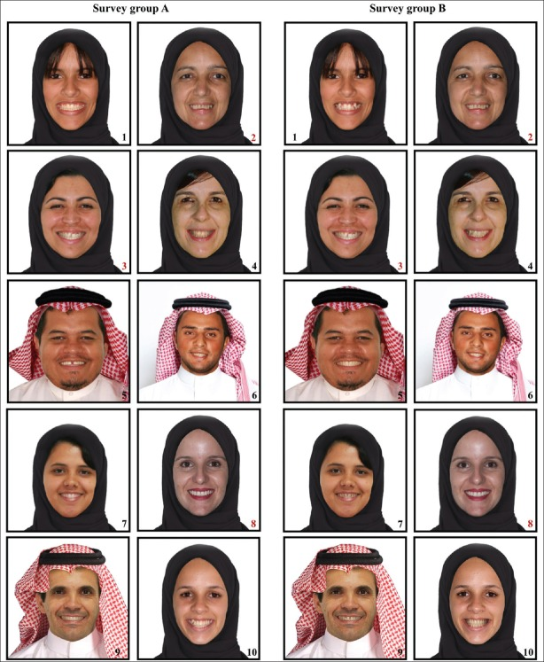 KhalidJoharji's tweet photo. دراسة تمت  على 280 مدير توظيف سعودي، اعطوهم 10 صور لسعوديين مبتسمين (الصورة مرفقة)

النتيجة: المتقدمون الذين يعانون من عيوب في الأسنان مقارنة بالابتسامة العادية كانوا أقل عرضة للتوظيف بنسبة 52٪

رابط الدراسة:
https://t.co/cPedFm2Zj8 https://t.co/jiQUKCBYpd