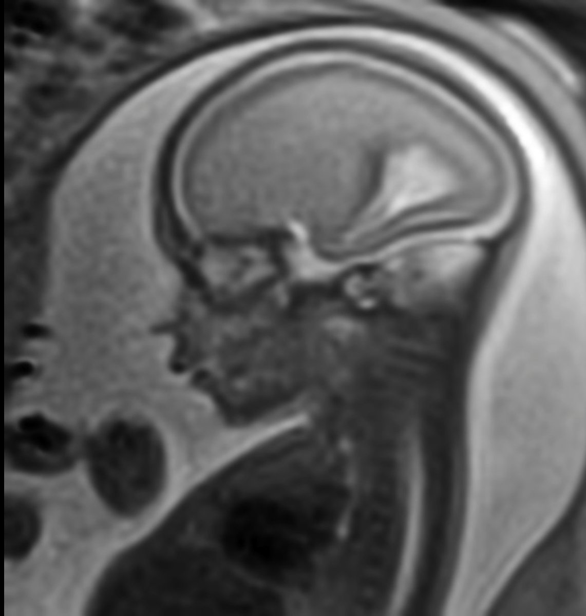 Arman Avesta, MD, PhD tweet media