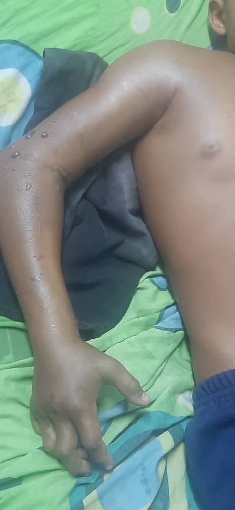 manosdlsangeles's tweet image. #urgente se urge niño de 13 años Recluido en el Hospital General Guarenas Guatire con mordedura de serpiente necesitamos trasladarlo a un hospital que con seguridad tenga el suero ANTIOFIDICO
