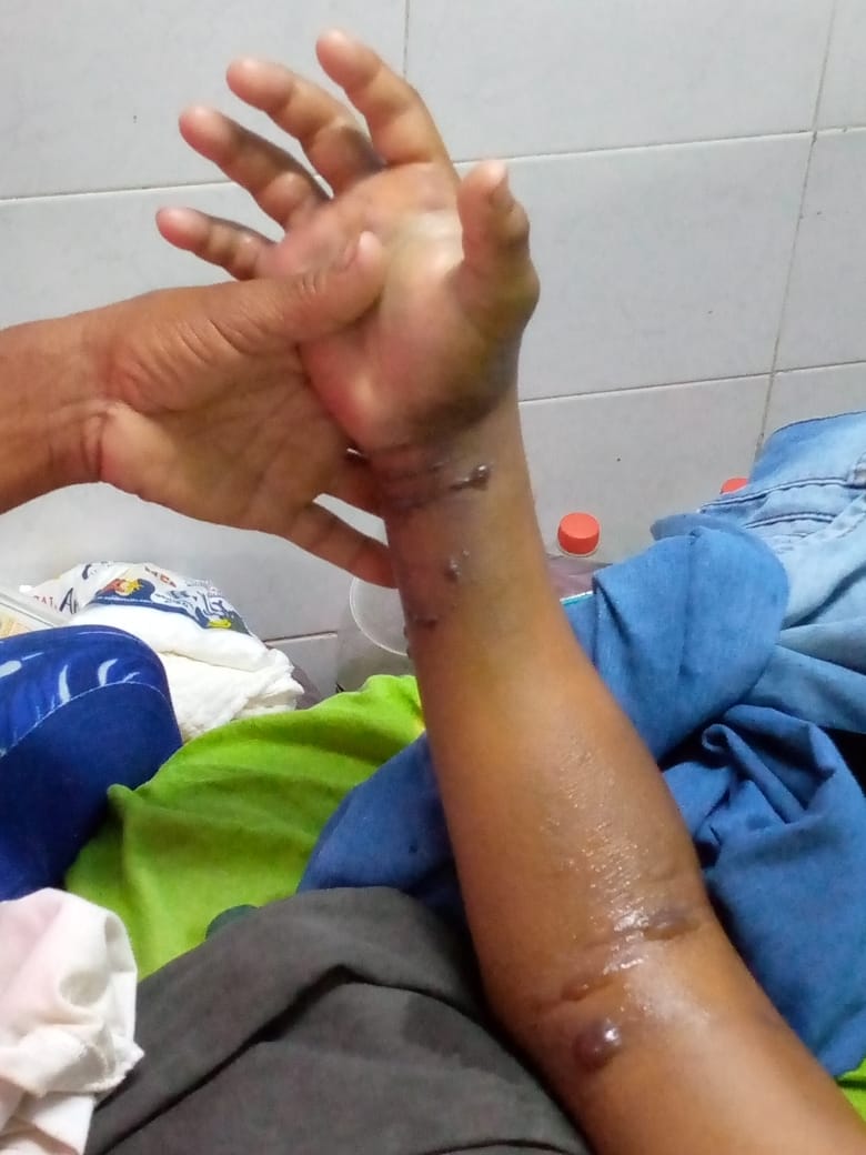 manosdlsangeles's tweet image. #urgente se urge niño de 13 años Recluido en el Hospital General Guarenas Guatire con mordedura de serpiente necesitamos trasladarlo a un hospital que con seguridad tenga el suero ANTIOFIDICO