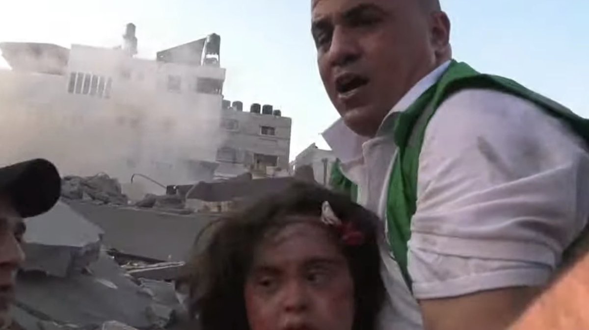 zakey's tweet photo. Down syndrome girl in Gaza 
God help the girl https://t.co/wlkdSbg4CT