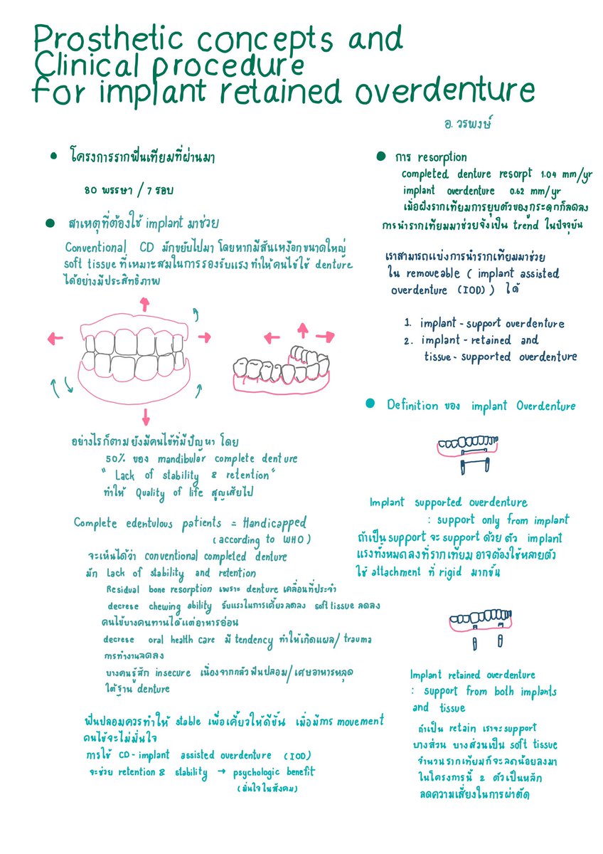 fonkansiri's tweet photo. ต่อเนื่องของ implant retained overdenture e-learning  อันนี้เป็น part อ.วรพงษ์ค่า ได้ไปฝึกงาน pick up กับคุณหมอที่สรรพสิทธิ เลยเห็นภาพขึ้น เลยเขียนเพิ่มไว้ในเลคเชอร์ด้วย หากขาดตกบกพร่องตรง���หนขออภัยน้าค่า #ADResiDent4 https://t.co/y1fEzIVG1x