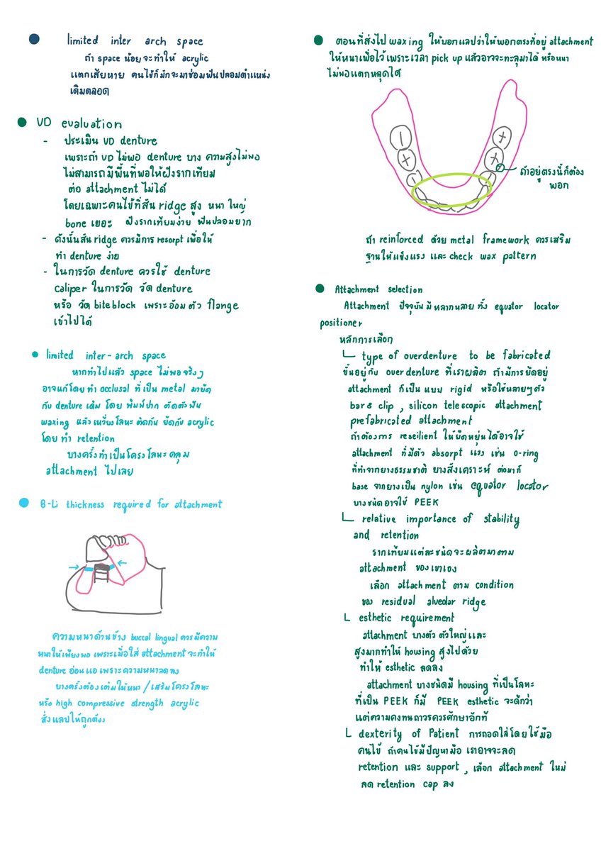 fonkansiri's tweet photo. ต่อเนื่องของ implant retained overdenture e-learning  อันนี้เป็น part อ.วรพงษ์ค่า ได้ไปฝึกงาน pick up กับคุณหมอที่สรรพสิทธิ เลยเห็นภาพขึ้น เลยเขียนเพิ่มไว้ในเลคเชอร์ด้วย หากขาดตกบกพร่องตรง���หนขออภัยน้าค่า #ADResiDent4 https://t.co/y1fEzIVG1x