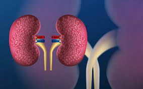 I noticed we are seeing a lot of patients with Kidney diseases. Lot of young people under 40 years. I tried to do a detailed list of some top kidney destroyers I noticed and how to prevent (with input from my colleagues) Please share and read if you see this. Thanks