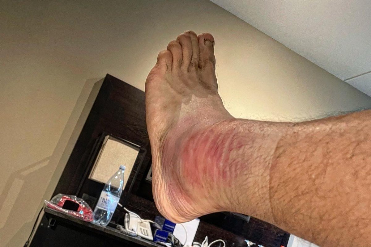 casquetteverte's tweet image. [⭐️🇸🇪 FINISHER KULLAMANNEN 2023 🇸🇪⭐️] • 2ième 🥈 en 15h 34 min 43 sec pour faire les 160 km | 2.200 m D+ de cette course suédoise 🇸🇪🐴🌧️🥶🌊💨🍂 • Résume ultra rapide (faut que je dorme) 🥱 • Un départ rapide, mais pas trop.. groupé avec les suédois et finlandais.. 🐕🐕🐕…