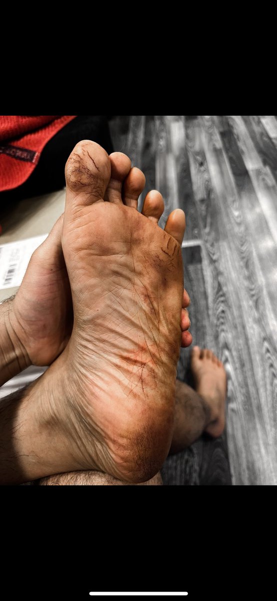 22.04.23 I still remember..it was one of the hottest days during the peak of summer..this was my feet after filming this episode on the 3rd day of the 25days..couldn’t walk properly..went away for a bit after it started to bleed..so My Director wanted to get the shot right n did