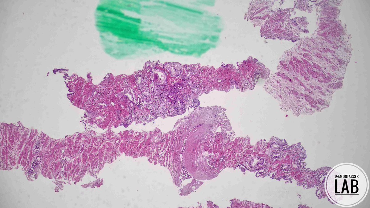 Ahmed Montasser tweet media