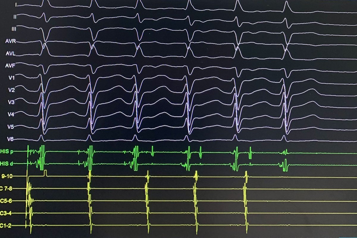 Rodrigo Isa Param tweet media