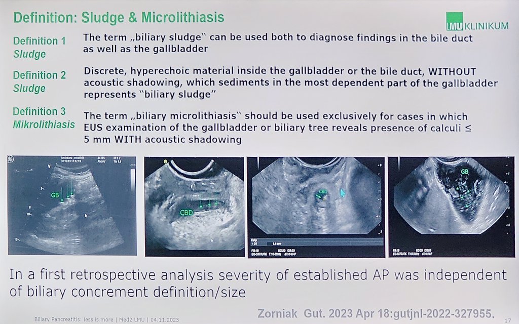 drRobinDud's tweet photo. Exelent lecture👌
by👸🏼Madam of Pancrea Prof. Julia Mayerle 🇩🇪
#FALK235 🇪🇸 Madrid
Importan 💡news abt
#sludge #microlithiasis #EUS and #ERCP in field of 🫴 #biliary #pancreatitis
✍🏻 #IdiopathicPancreatitis
��� 30-40% billary etiology
post 🫴EUS https://t.co/d8iBrLmWbE