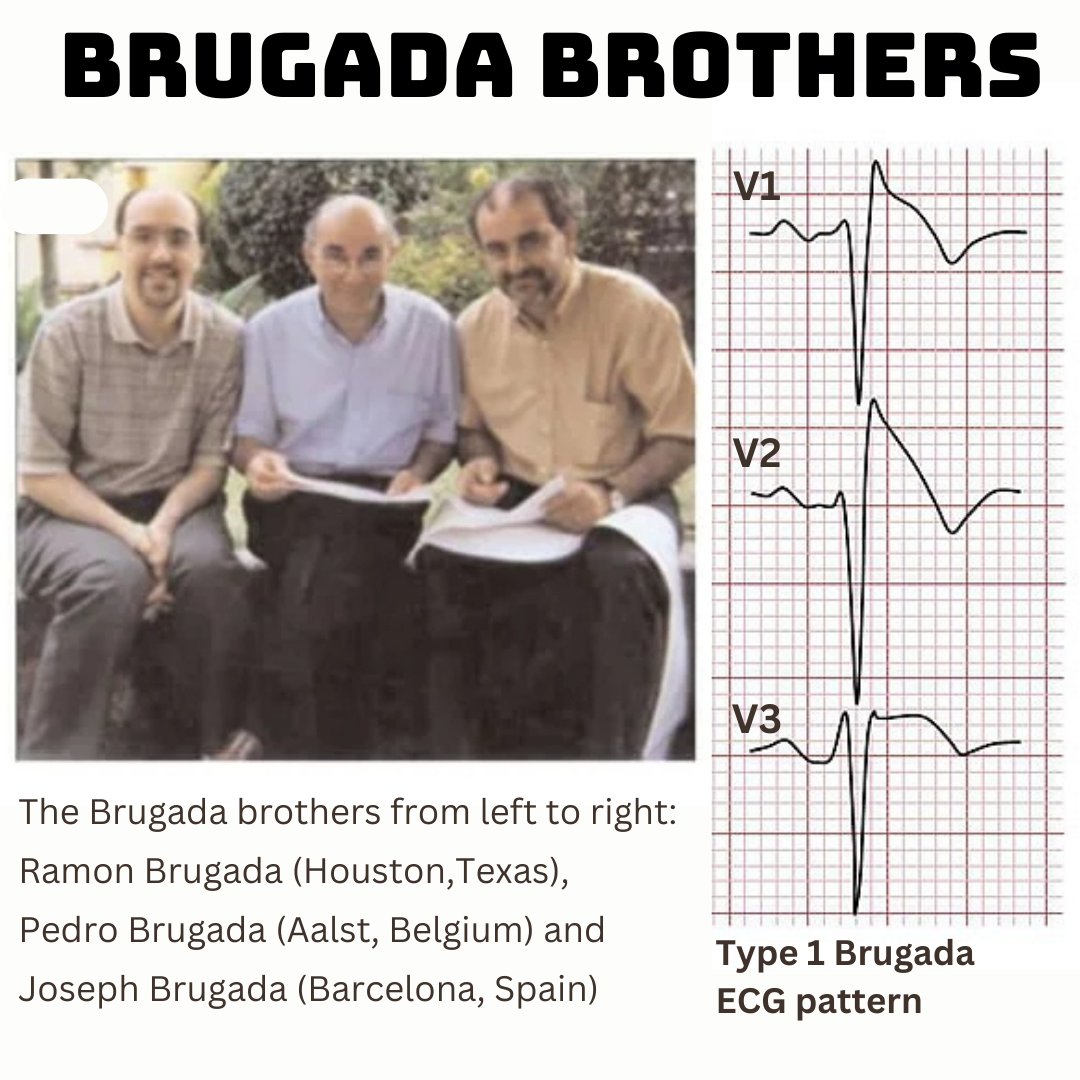 The BRUGADA family has contributed immensely to field of
🫀Cardiology &amp; Electrophysiology 

A 🧵 on 

💥𝗕𝗥𝗨𝗚𝗔𝗗𝗔 𝗘𝗣𝗢𝗡𝗬𝗠𝗦 
☑️Brugada Syndrome
✅️Brugada Pattern
☑️Brugada Phenocopy
✅️Brugada Algorithm
☑️Brugada Criteria
✅️Brugada Sign

#MedTwitter #MedX
Read on👇