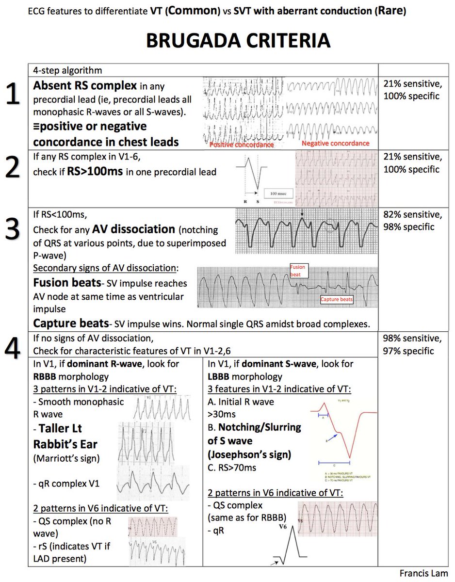 the-brugada-family-has-contributed-immensely-to-field-of-cardiology