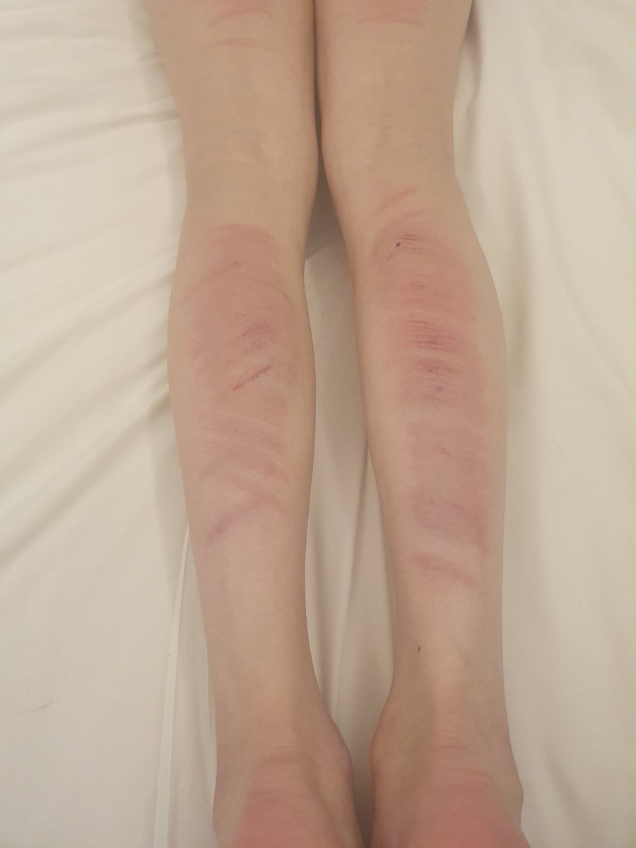 즐거운스팽 그리고 이제 회복기간..