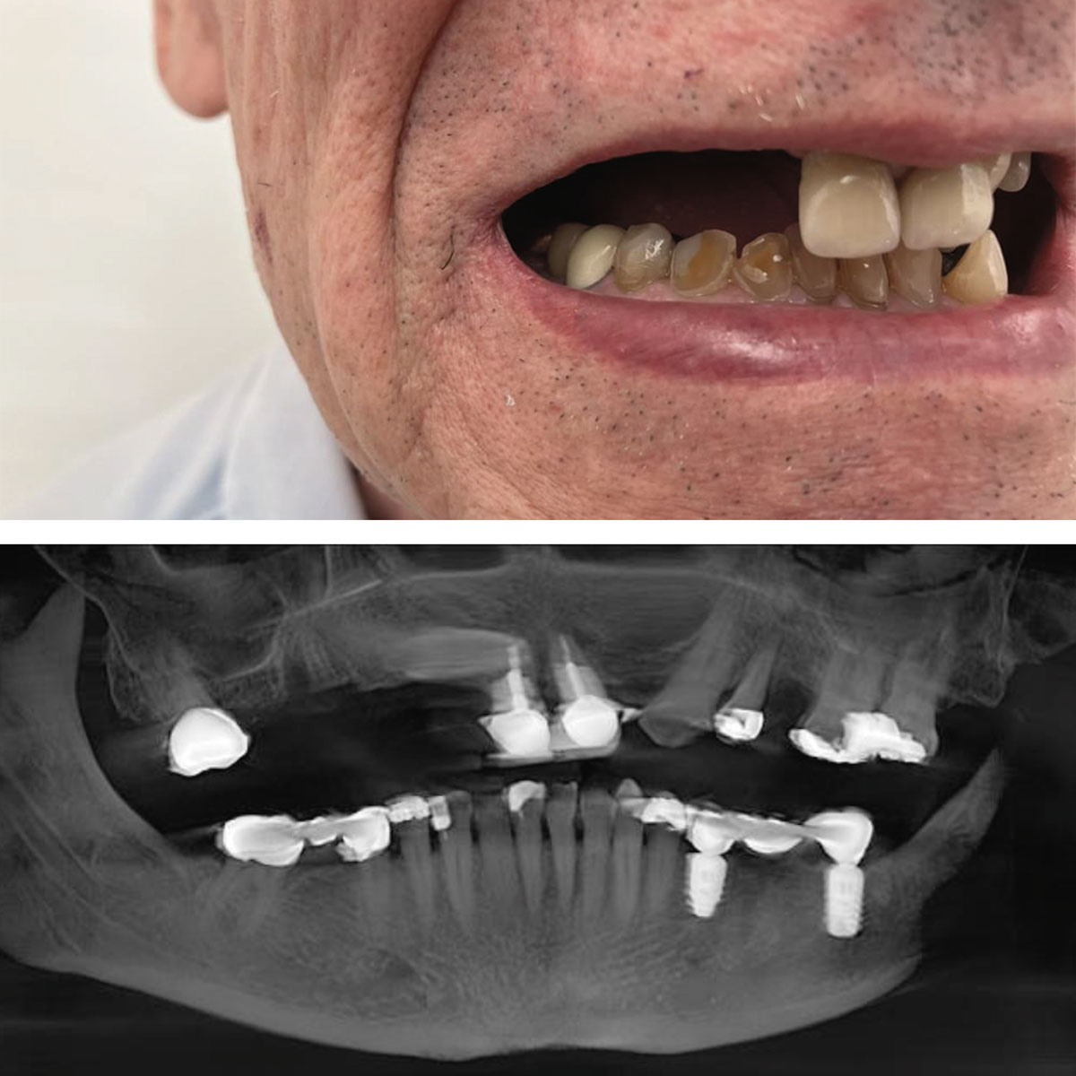 Implant Practice US - Dental Continuing Education tweet media