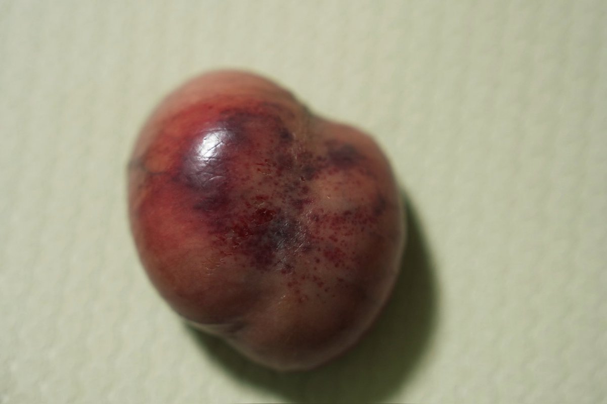 被打蛋機鞭打後賤蛋腫了4公分