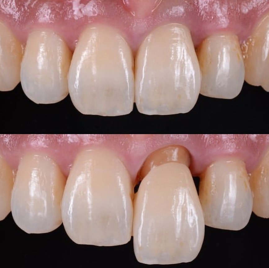 ronle_001 | 🐐 | #Metatime tweet media