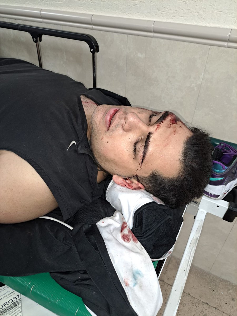 Rodrigo Fragoso (@fragosomanager) on Twitter photo Esta mañana elementos de la <a href="/SS_Edomex/">Secretaría de Seguridad del Estado de México</a> atropellaron a mi hermano Alexandro y a su esposa. Hoy están muy graves en un hospital con múltiples Fracturas. EXIGIMOS JUSTICIA y una profunda investigación. <a href="/delfinagomeza/">Delfina Gómez A.</a> <a href="/UAI_EDOMEX/">Unidad de Asuntos Internos - Edomex.</a> <a href="/angiemoyam/">Angélica Moya</a> <a href="/AAndradeTellez/">Andrés Andrade Téllez</a> <a href="/FiscaliaEdomex/">Fiscalía Edoméx</a> <a href="/GobNau/">Ciudad Naucalpan / Gobierno Municipal 2025-2027.</a> Esta mañana elementos de la <a href="/SS_Edomex/">Secretaría de Seguridad del Estado de México</a> atropellaron a mi hermano Alexandro y a su esposa. Hoy están muy graves en un hospital con múltiples Fracturas. EXIGIMOS JUSTICIA y una profunda investigación. <a href="/delfinagomeza/">Delfina Gómez A.</a> <a href="/UAI_EDOMEX/">Unidad de Asuntos Internos - Edomex.</a> <a href="/angiemoyam/">Angélica Moya</a> <a href="/AAndradeTellez/">Andrés Andrade Téllez</a> <a href="/FiscaliaEdomex/">Fiscalía Edoméx</a> <a href="/GobNau/">Ciudad Naucalpan / Gobierno Municipal 2025-2027.</a>