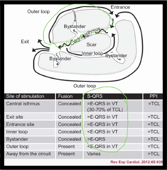 ChartAcademy's tweet photo. 📅 Lock your calendar - 2 EP Pro courses!
1️⃣ Ischemic VT Course on 11/14
2️⃣ PVC Localization Course on 12/12
https://t.co/nPaSYearOP🤓
Blogs on determining PVC origin by @epnerdjen!
🌎https://t.co/RntCrxPByu
📱https://t.co/z4qo5DKTSa
#BuildConfidence #EPNerd #EPeeps #VivaEP https://t.co/OnENtzMcqD