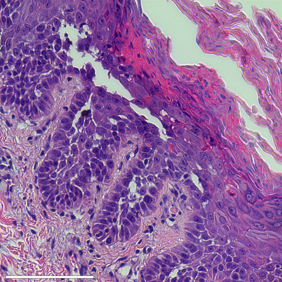 Cory Simpson, MD, PhD, FAAD (he/him) tweet media