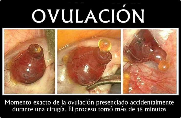 OVULACIÓN HUMANA

En 2008, el doctor Jacques Donnez fue el primer hombre en la historia en captar a través de imágenes el proceso de ovulación. 

Las imágenes fueron captadas de forma espontánea, durante una histerectomía parcial (extirpación del útero) a una mujer de 45 años.