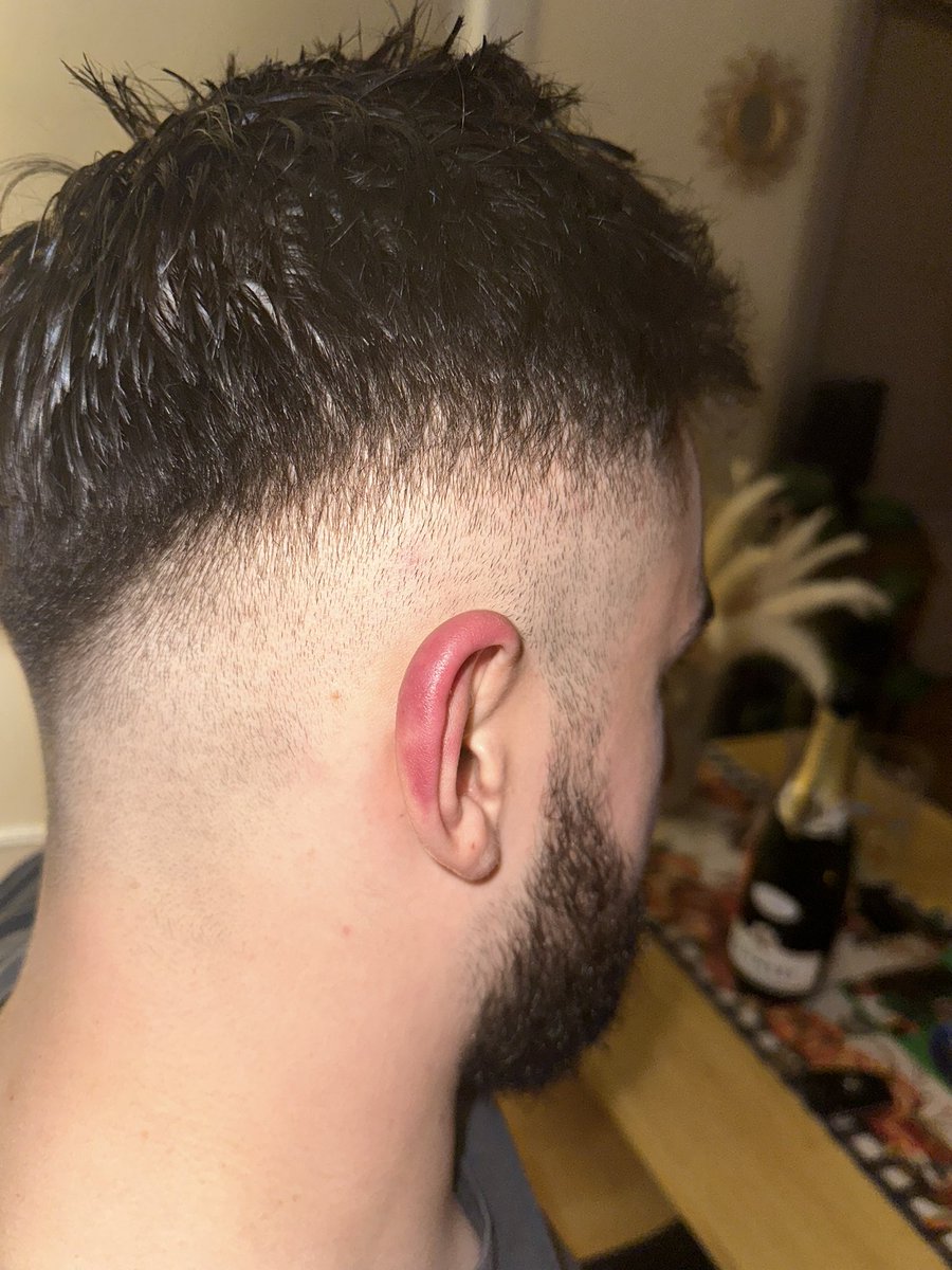 Archie on X: Looking for a spare pair of ears t.coNgU9P4tddF  X
