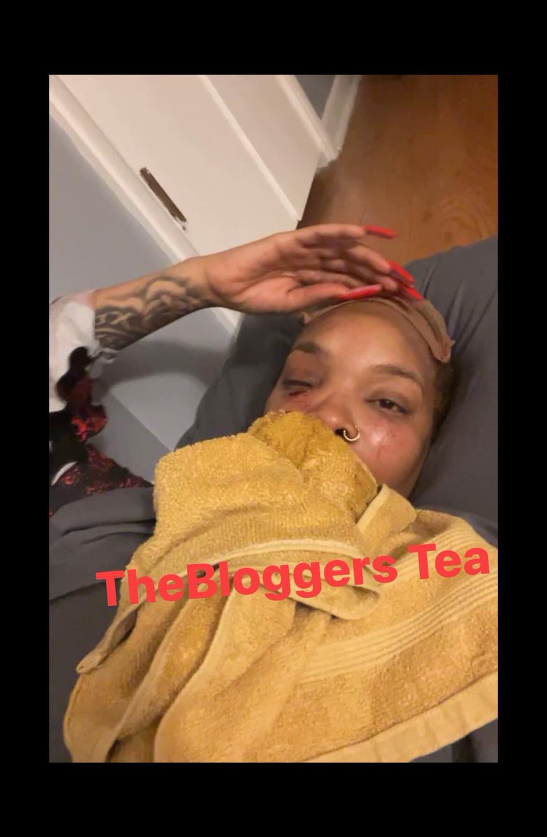 dabiggesttdon's tweet image. Deafbae went to see her new gf and look what she did , I hate that for her