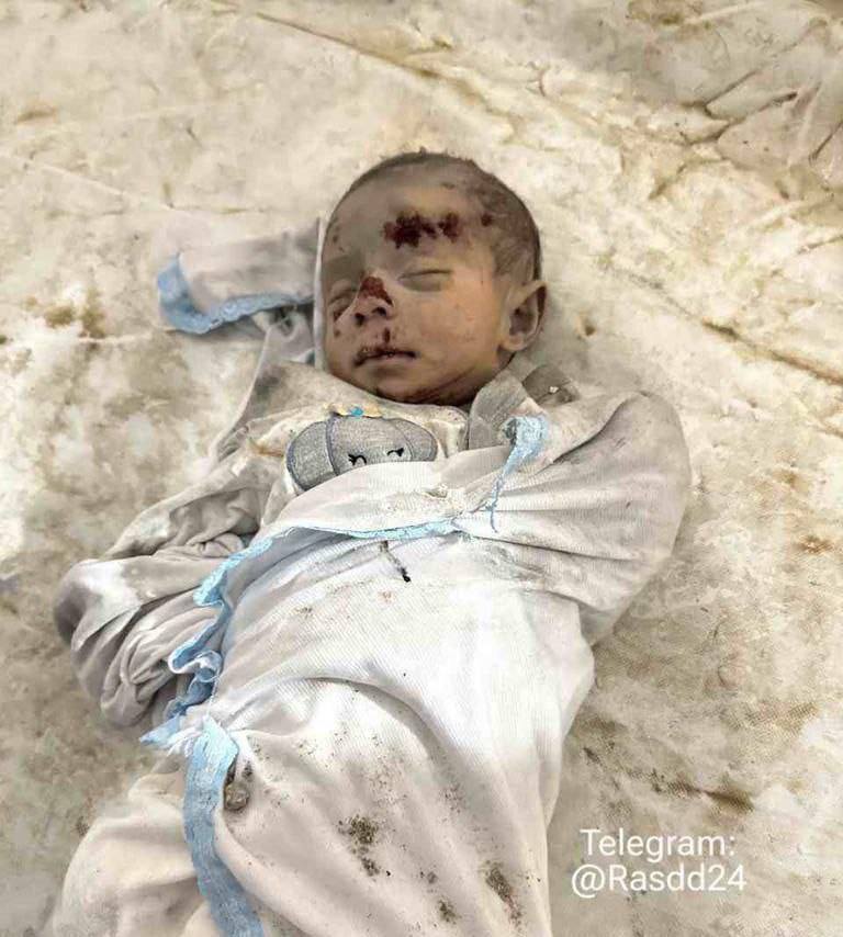 TamerMisshal's tweet photo. طفل ارتقى قبل قليل في مجزرة مخيم المغازي 
" وسيعلم الذين ظلموا أي منقلب ينقلبون" https://t.co/QnBFcogTYR
