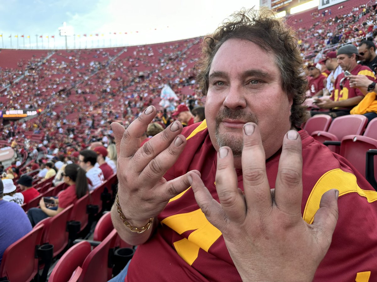 VicTheMacWizard's tweet photo. My #Psychogate ✌🏻 battle scars. #FightOn ✌🏻 #BeatTheHuskies  ✌🏻#EatMoreDog ✌🏻#FireAlexGrinch ✌🏻 #WeAreSC https://t.co/OfkkikiA6p