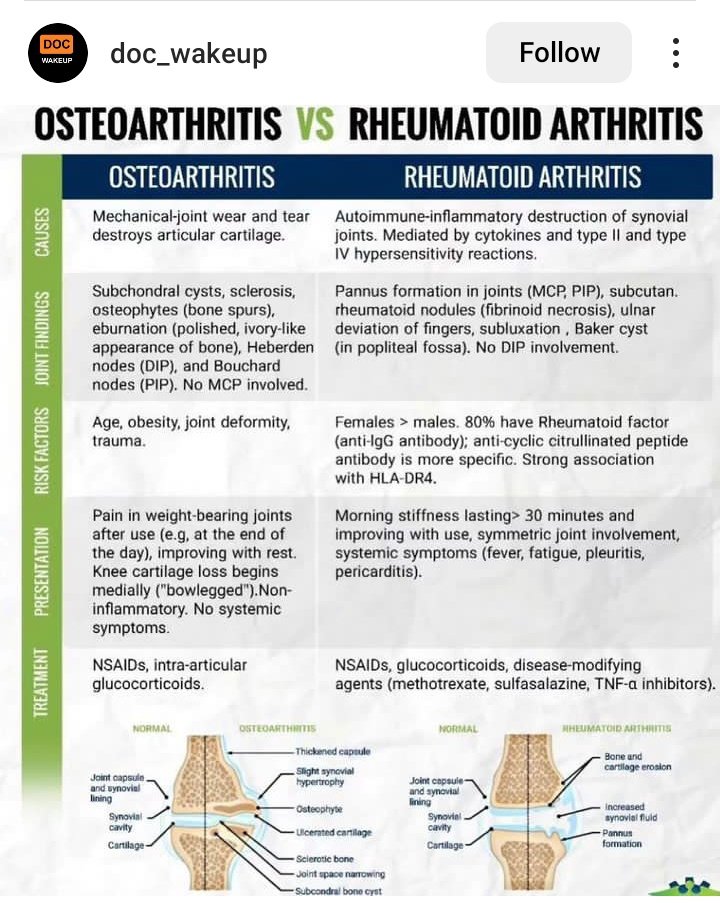 The difference between osteoarthritis and rheumatoid arthritis...
@AprokoPhamacist @AshutoshSinghMD @d_ogera @Chulbulpanda420 @dr_Hypertension @DrAmeen34 @GeorgeAnagli @drkeithsiau @simplify_drugs @pharmradio @MedscapePharm @damilare_jamal @Dr_AustinOmondi .