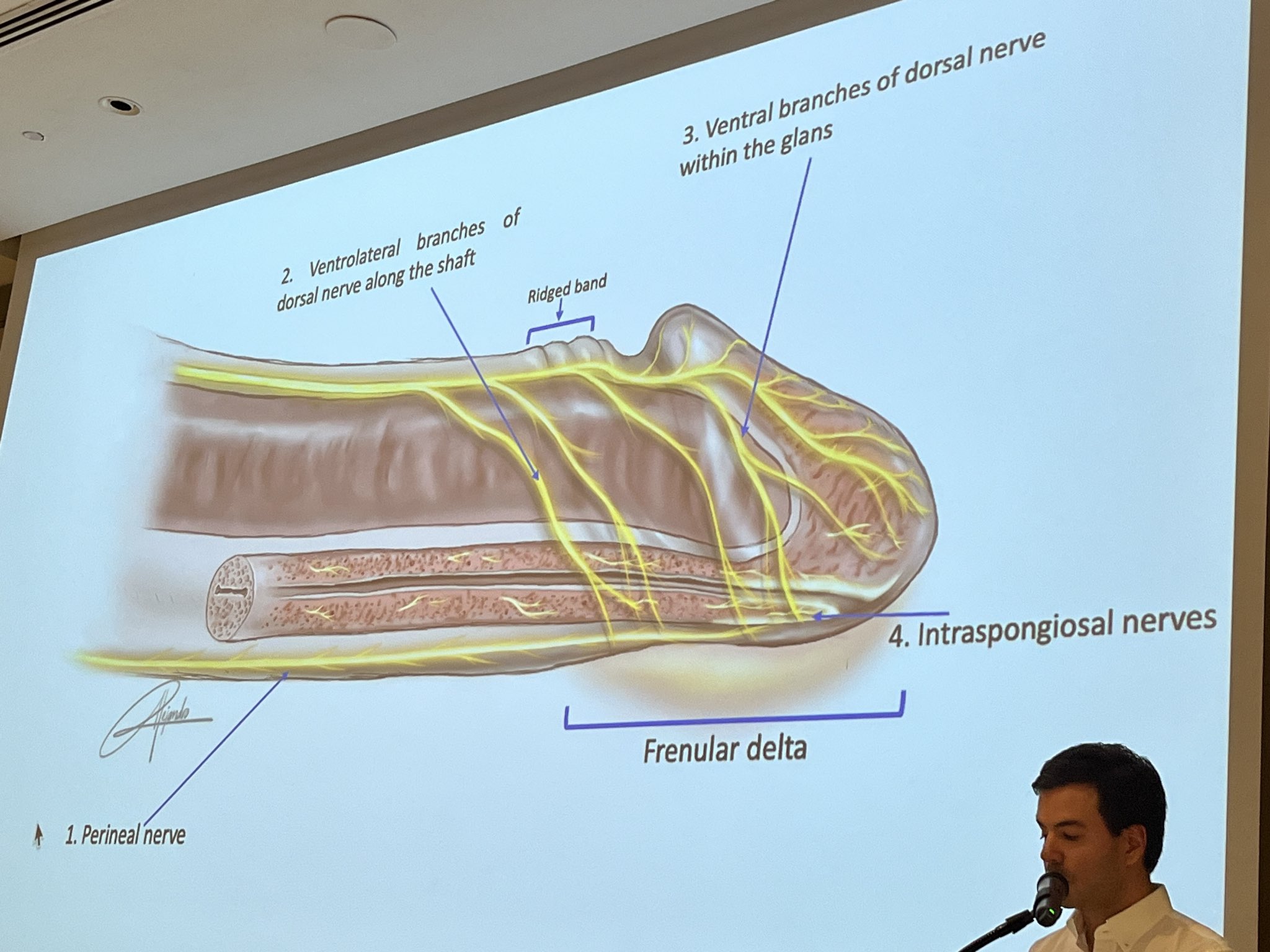 Brian D. Earp, Ph.D. on X: "He argues this is due to the unique, dense  confluence of four different types of nerves in the foreskin frenular delta  (“the male F-spot”) https://t.co/CfcON8MQcP" /