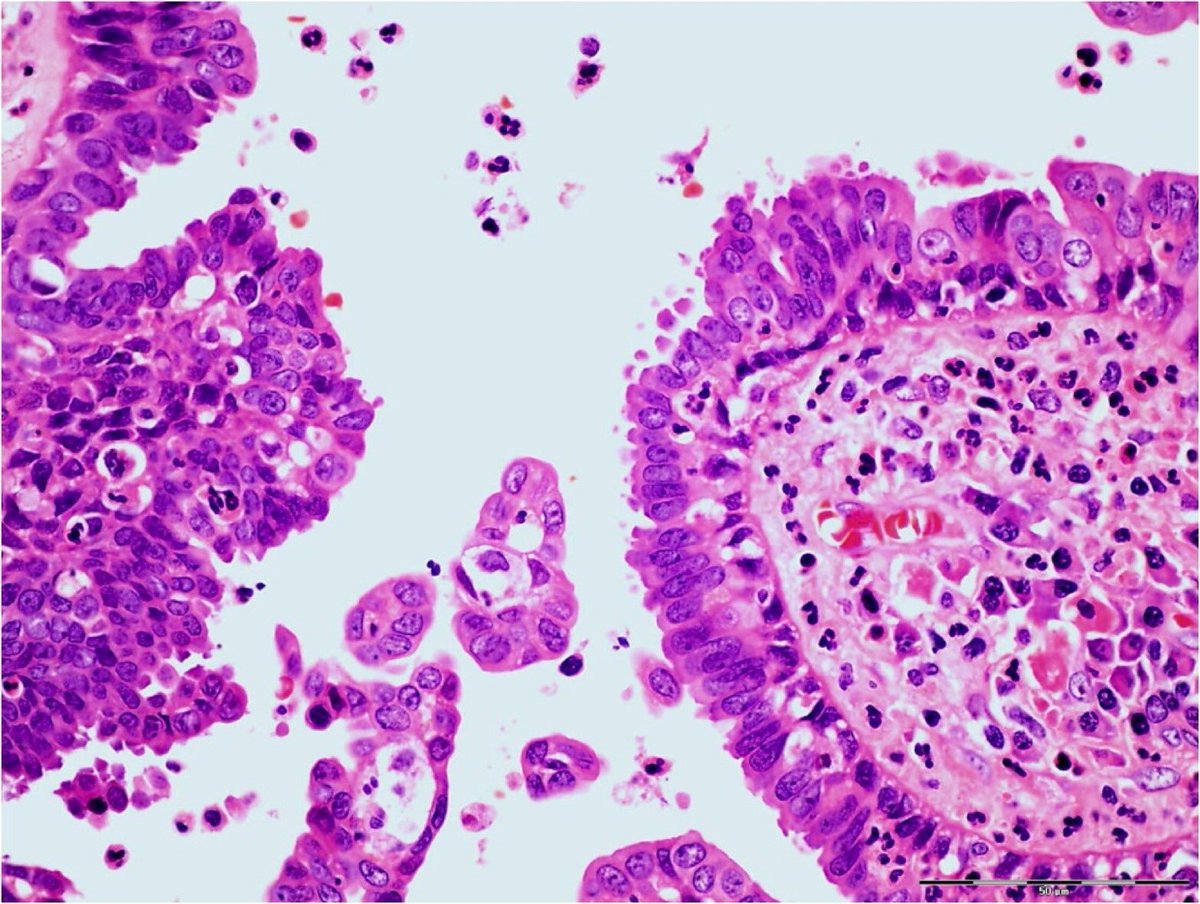 DermpathIndia (@dermpathi) on Twitter photo 