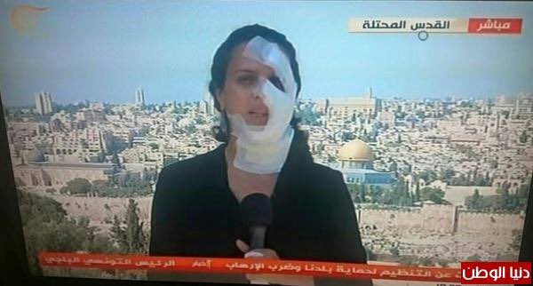 Journalist Hana Mahameed back on screen after being hit in face by 'Israeli grenade' in East Jersualem

Was Hamas hiding in her face?