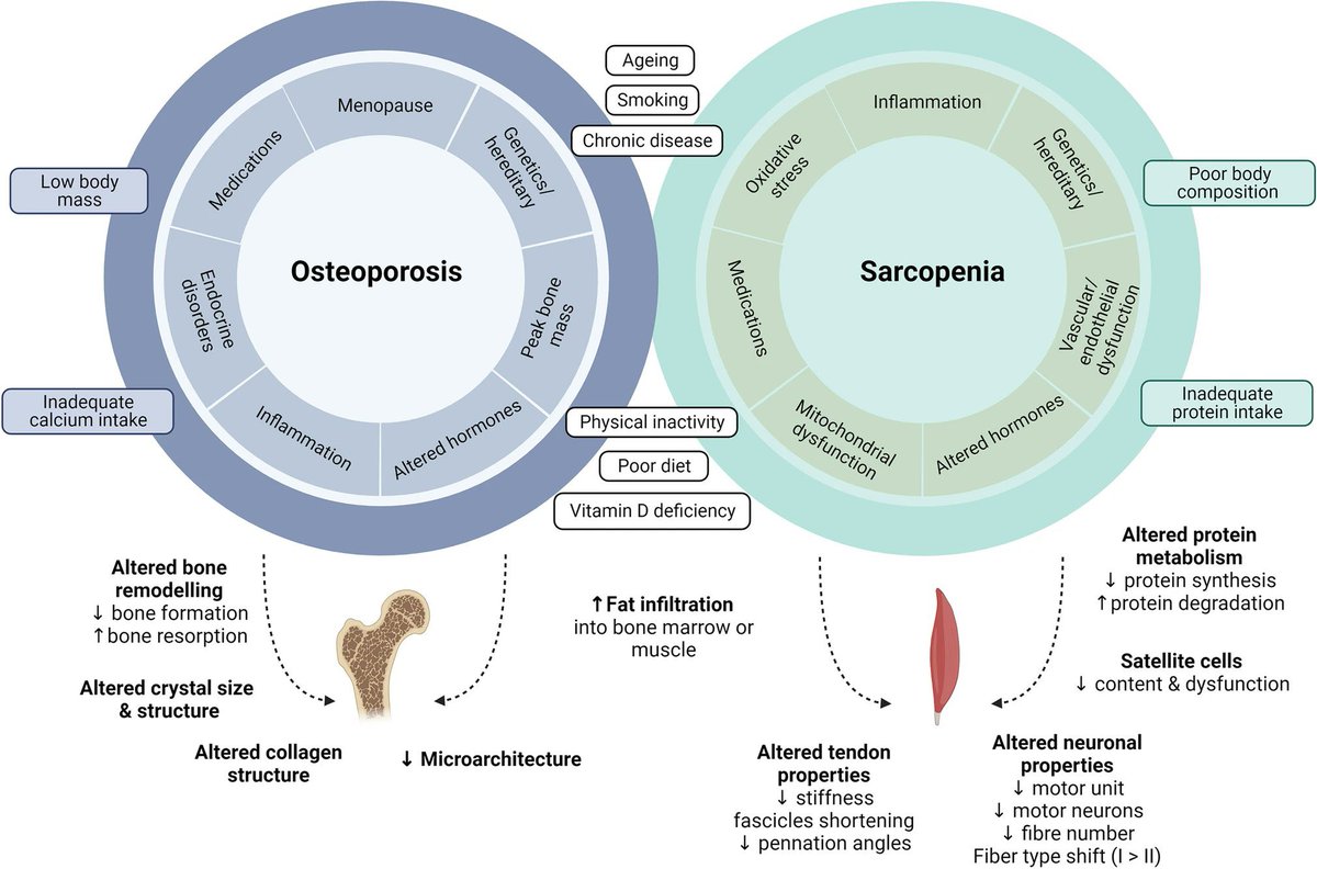 med__gym's tweet image. 🦴 OSTEOPOROSIS Y SARCOPENIA 💪

La relación entre el hueso y el tejido muscular cada vez adquiere mayor evidencia 📈

Esta es bidireccional, influyendo en la salud sistémica de forma directa ⚠️

El ejercicio es clave para tratar ambas dolencias 🏃🏽‍♂️

link.springer.com/article/10.100…