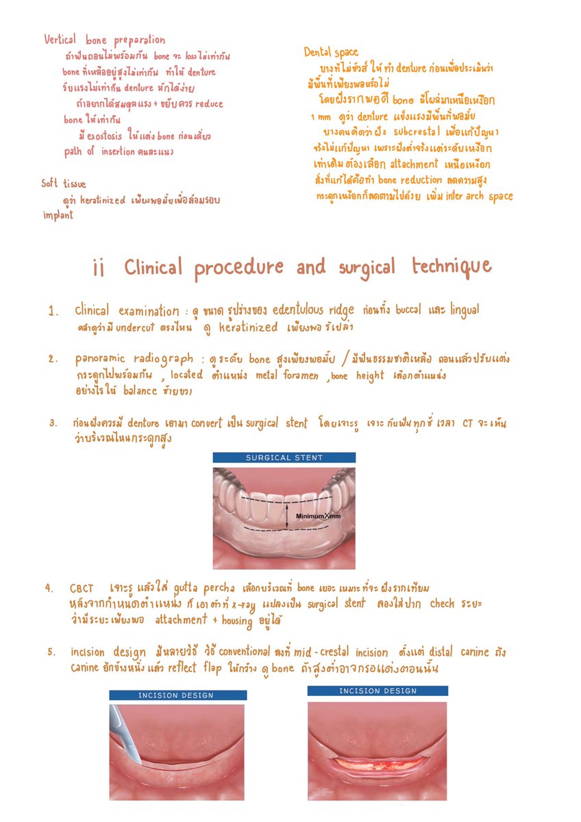 fonkansiri's tweet photo. Surgical planing concept ของ PRK #ADResiDent4 https://t.co/NHjuZNzqqI