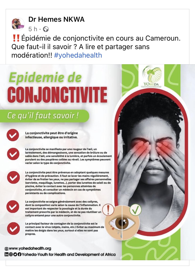 2015_alida's tweet photo. Bon à savoir sur la conjonctivite https://t.co/crvkKvk9vo