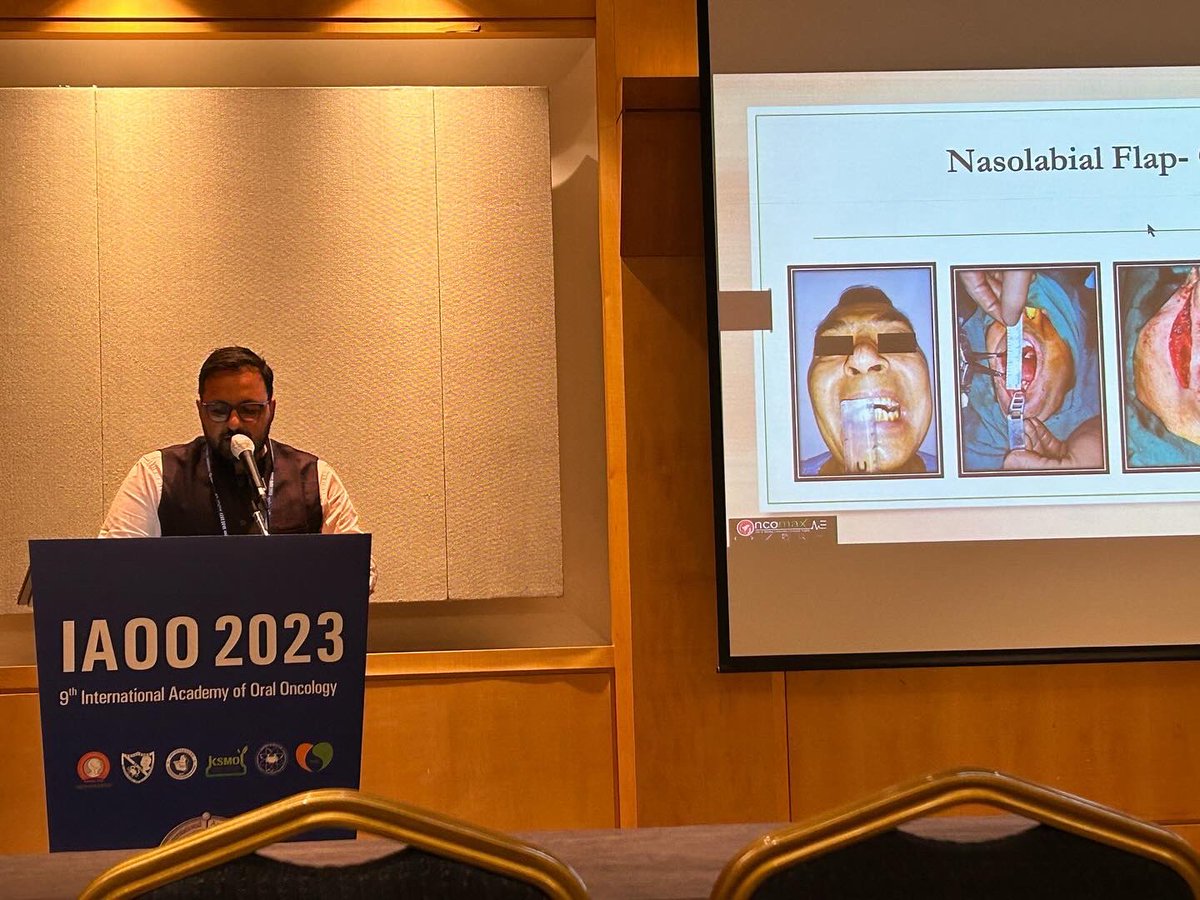 themaxfacguy's tweet image. It was a pleasure to present the work done by my team (OncomaxNE) in oral cancer at the International Association of Oral Oncology (IAOO 2023) held at South Korea.

#oralcancer #aomsi #maxillofacial #omfs #reconstruction #guwahati #iaoms #iaoo #northeast