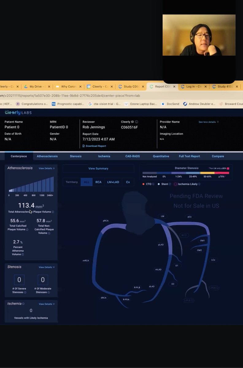 altcap's tweet image. This summer on #136 of @theallinpod, I hijacked 
science corner to discuss heart health.  I suggested everybody over 40 do a Calcium CT Scan &amp;amp; if your score is non-zero you should likely be taking a statin.  Many have shared ++ stories how this impacted them, so wanted to follow…