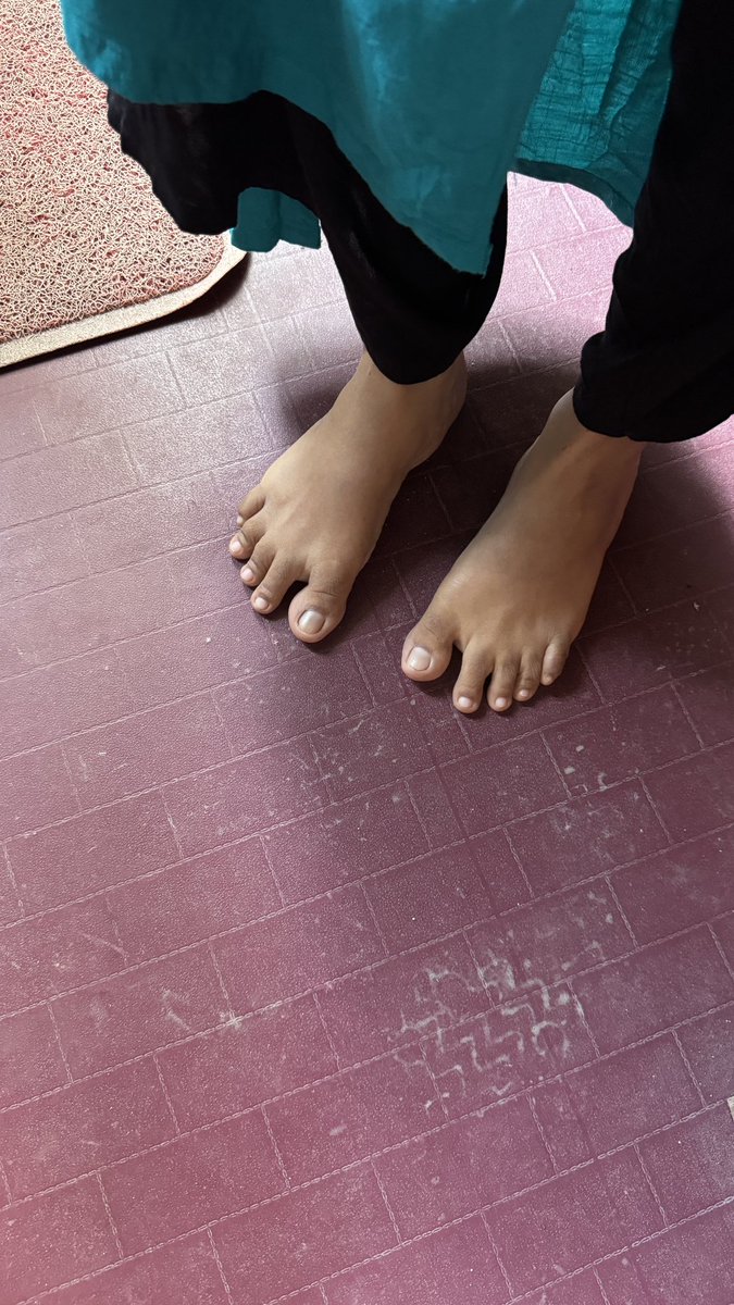 MyFootFunction's tweet image. Currently conducting the world’s first of its kind study on feet & the impact shoes have. The goal is to study 1,000 people in 30 days. #theshoeeffect #SriLanka23