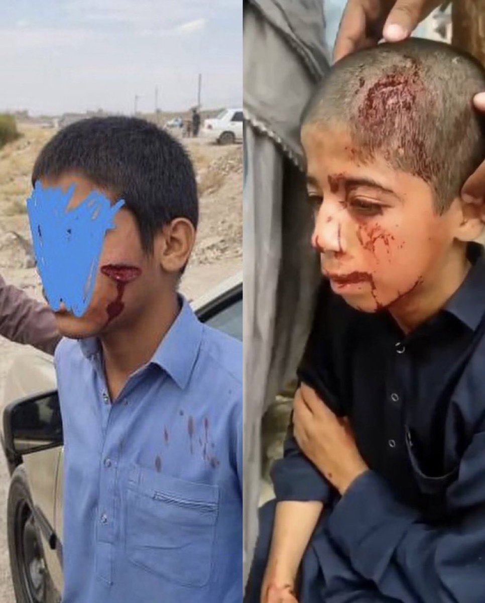 nickbot21's tweet image. If you haven’t been speaking out against the Islamic Republic terrorist regime in Iran because you’re worried about your safety but when it comes to Gaza, your advocacy is anti-Israel, then you are advocating for what Khamenei allows you not for humanity!

This is Iran not Gaza👇