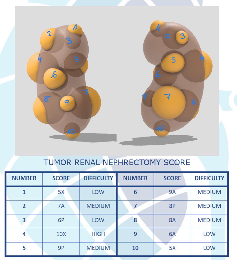Our training model for #partialnephrectomy, featuring 10 tumors of varying surgical complexities, will soon be available, offering high-quality education at unmatched value. Stay tuned! #SurgicalTraining #Nephrectomy 
 #training #TrainingForEveryone #urology3D #ComingSoon