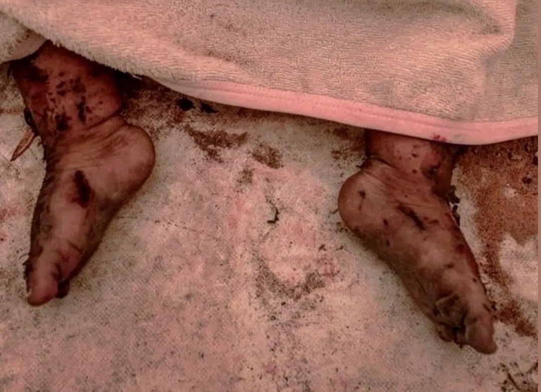 “Ben ne yapabilirim ki bu zalimliği durdurabilmek için? Sadece 1 kişiyim.” dedi, 8 milyar insan…