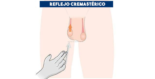 Sofhia_Rodelo's tweet photo. 📍Reflejo cremastérico: contracción del músculo cremastérico, que provoca el ascenso del testículo al estimular la cara interna del muslo. Se encuentra abolido en caso de torsión y presente en la orquiepididimitis. https://t.co/9JryLkLT7I