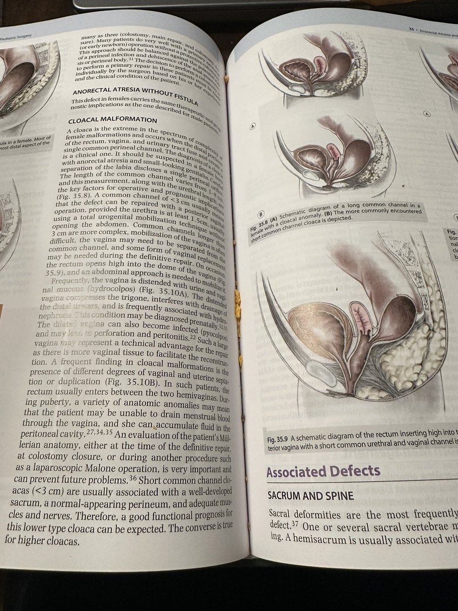 Brittany Levy MD MPH (@brittanylevymd) on Twitter photo Turns out snacking and studying at the same time is dangerous for bindings. #SavingForLater #StudySnacks <a href="/UKPedSurg/">UK Pediatric Surgery</a> <a href="/katimcc22/">Kate Marie</a> Turns out snacking and studying at the same time is dangerous for bindings. #SavingForLater #StudySnacks <a href="/UKPedSurg/">UK Pediatric Surgery</a> <a href="/katimcc22/">Kate Marie</a>