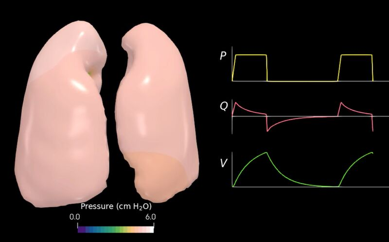 DanielEHurtado1's tweet photo. 🫁Patients connected to #mechanicalventilation show high heterogeneity in response. What causes such variability in #lungmechanics? Can #machinelearning and #lungmodeling provide an answer? Check out our recent #hotofthepress paper on this and much more! 👉🏽https://t.co/ODjNQBEXxY https://t.co/BhfM7f6pPy