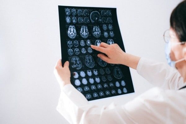 LEAD_Coalition's tweet photo. The Brain That Defied #Alzheimers: Her brain had all the signs of Alzheimer’s. She never got it. What can she teach us? https://t.co/I6Uh6ni1uM 

#dementia #science https://t.co/gCWd5NcZpC