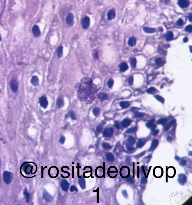 ColegioOaxaca's tweet image. Y ahora unos microorganismos de la semana 🐛🔬#pathbugs