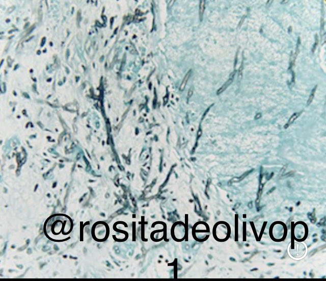 ColegioOaxaca's tweet image. Y ahora unos microorganismos de la semana 🐛🔬#pathbugs