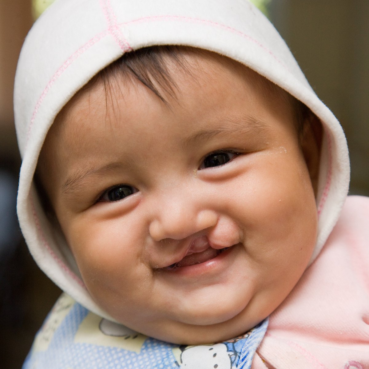 Hope everyone had a smile-filled weekend 😀 #cleftstrong #mission #volunteer #smiles